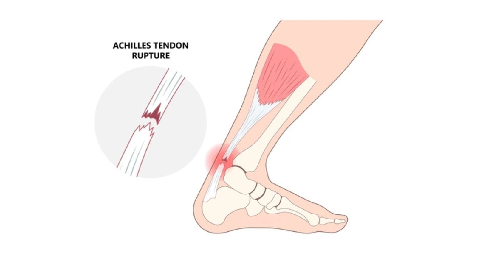 Treatment Options