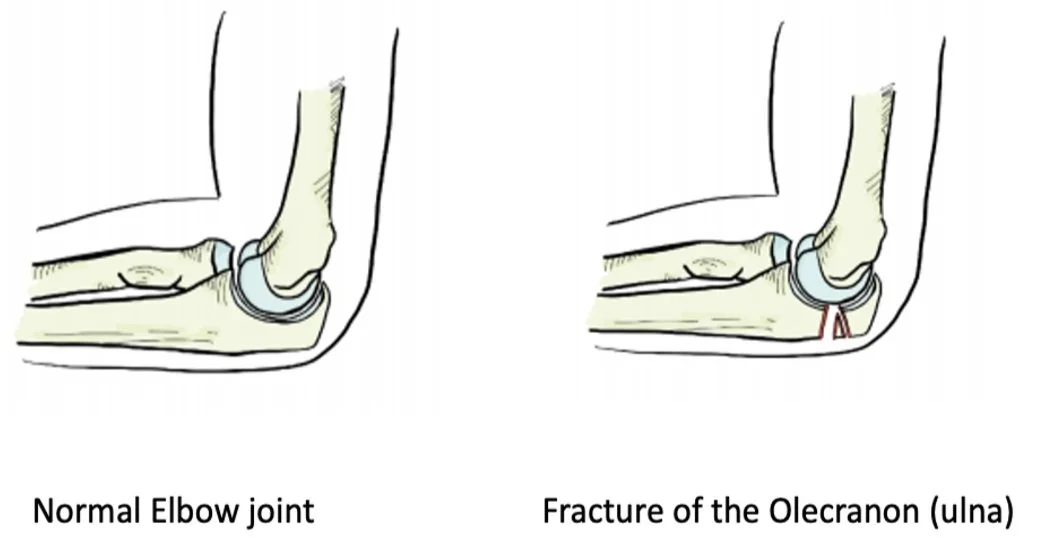 Treatment Options