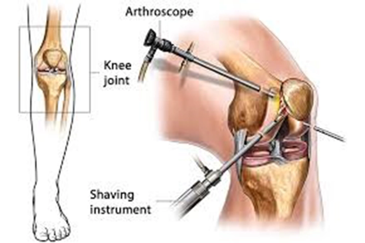Treatment Options