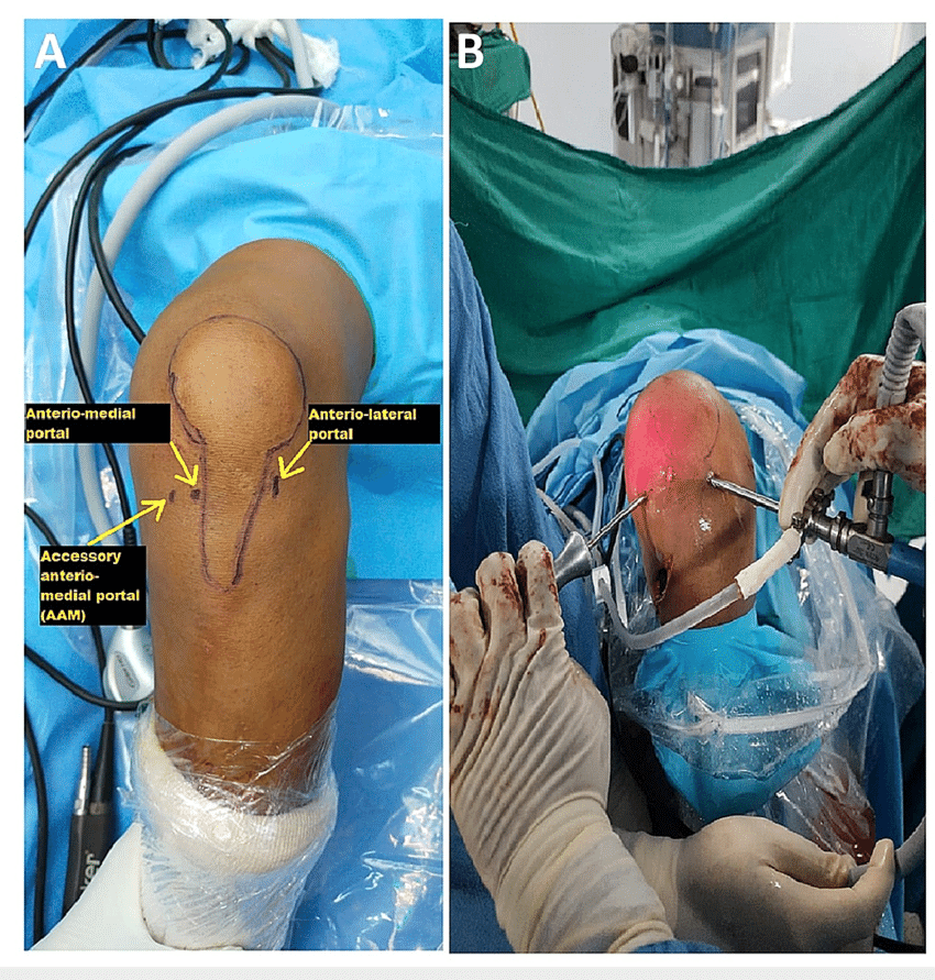 Treatment Options