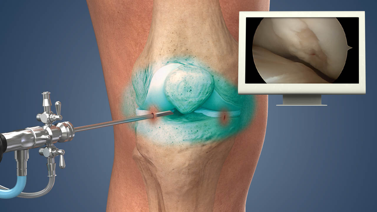 Treatment Options